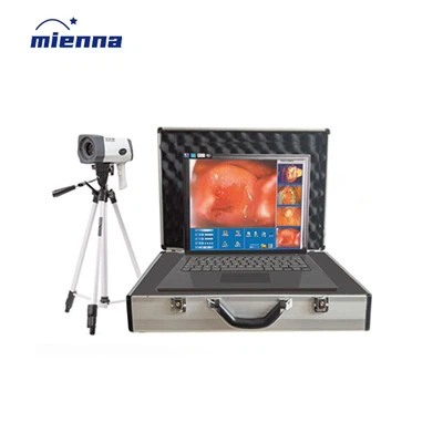 Ķirurģiskās ginekoloģijas digitālais elektroniskais kolposkops